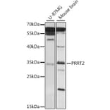 Western Blot - Anti-PRRT2 Antibody (A89419) - Antibodies.com