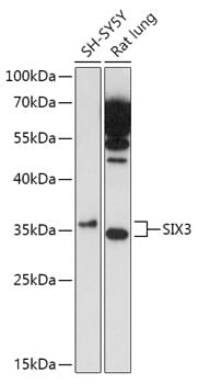 Western blot analysis of extracts of various cell lines, using Anti-SIX3 Antibody (A17363) at 1:1,000 dilution.
Secondary antibody: Goat Anti-Rabbit IgG (H+L) (HRP) (AS014) at 1:10,000 dilution.
Lysates / proteins: 25µg per lane.
Blocking buffer: 3% non-fat dry milk in TBST.
Detection: ECL Enhanced Kit (RM00021).
Exposure time: 3min.