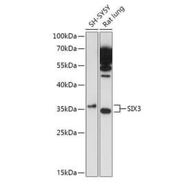 Western Blot - Anti-Six3 Antibody (A89420) - Antibodies.com