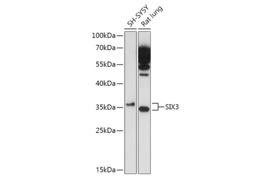 Western Blot - Anti-Six3 Antibody (A89420) - Antibodies.com