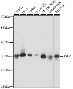 Western blot analysis of extracts of various cell lines, using Anti-TSFM Antibody (A16094) at 1:1,000 dilution.
Secondary antibody: Goat Anti-Rabbit IgG (H+L) (HRP) (AS014) at 1:10,000 dilution.
Lysates / proteins: 25µg per lane.
Blocking buffer: 3% non-fat dry milk in TBST.
Detection: ECL Basic Kit (RM00020).
Exposure time: 1s.