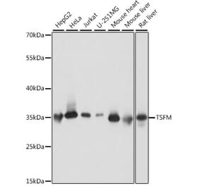 Western Blot - Anti-EF-Ts Antibody (A89421) - Antibodies.com