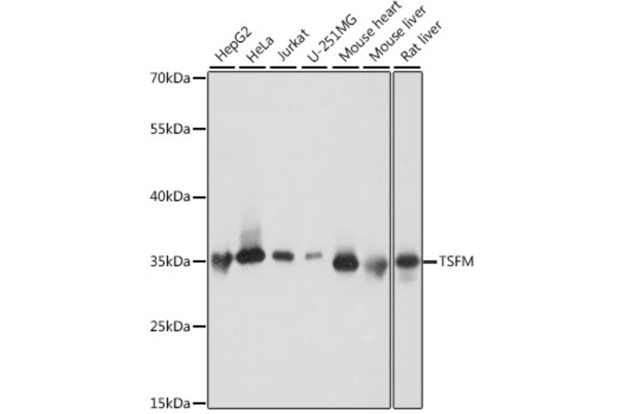 Western Blot - Anti-EF-Ts Antibody (A89421) - Antibodies.com
