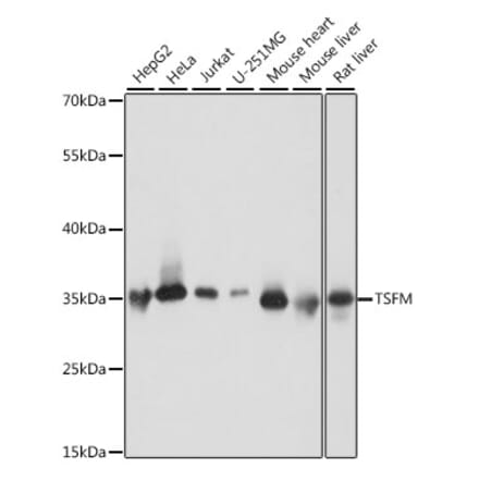 Western Blot - Anti-EF-Ts Antibody (A89421) - Antibodies.com