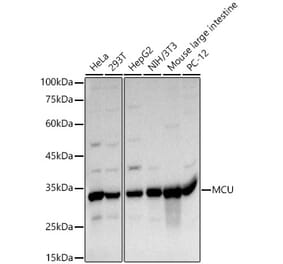 Western Blot - Anti-MCU Antibody (A89422) - Antibodies.com