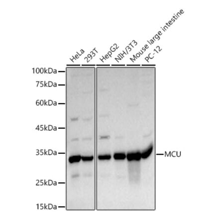 Western Blot - Anti-MCU Antibody (A89422) - Antibodies.com