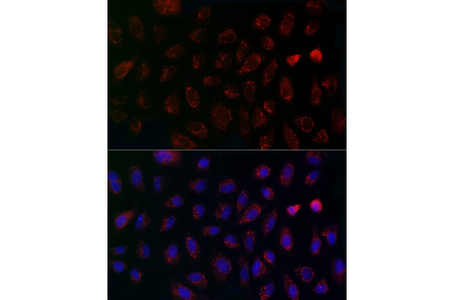 Immunofluorescence - Anti-MCU Antibody (A89422) - Antibodies.com