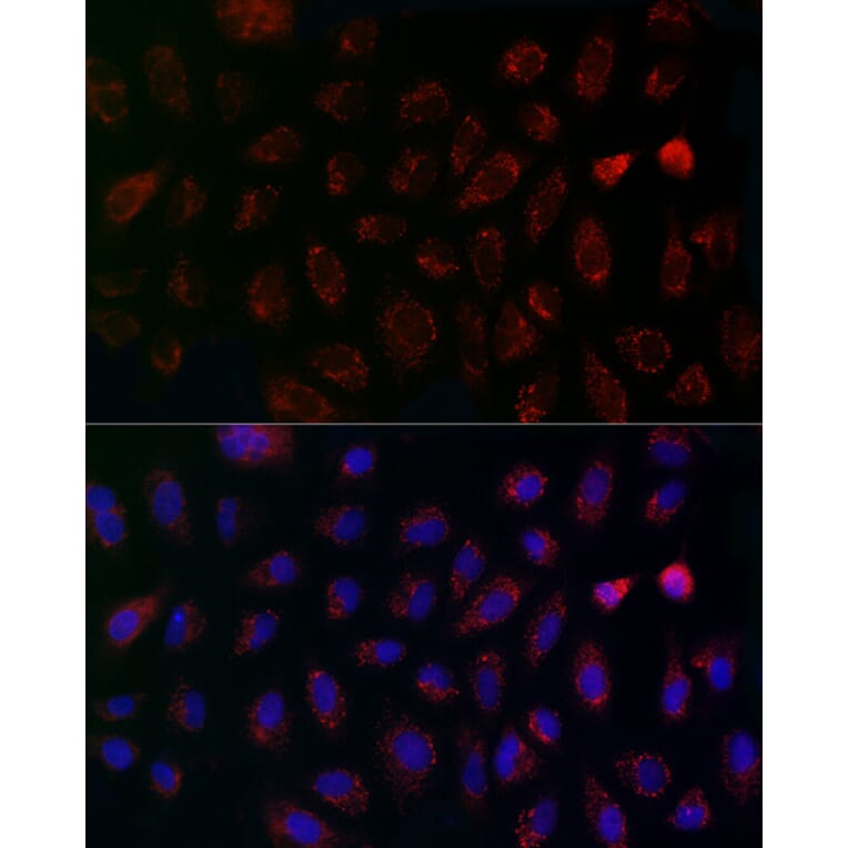 Immunofluorescence - Anti-MCU Antibody (A89422) - Antibodies.com