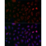 Immunofluorescence - Anti-MCU Antibody (A89422) - Antibodies.com