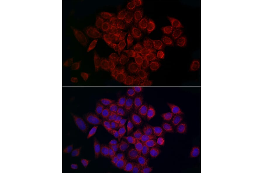 Immunofluorescence - Anti-MCU Antibody (A89422) - Antibodies.com