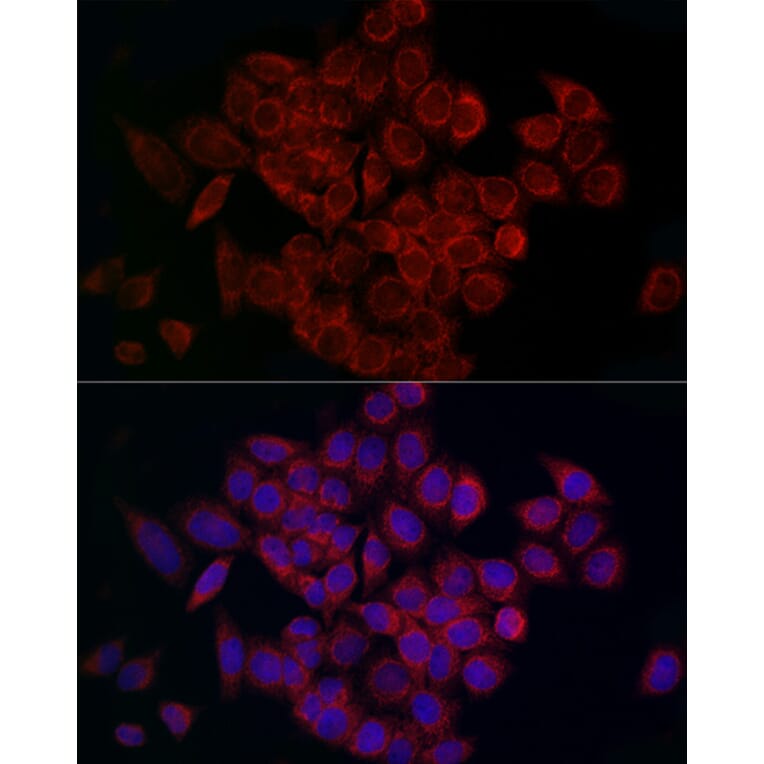 Immunofluorescence - Anti-MCU Antibody (A89422) - Antibodies.com