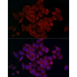 Immunofluorescence - Anti-MCU Antibody (A89422) - Antibodies.com