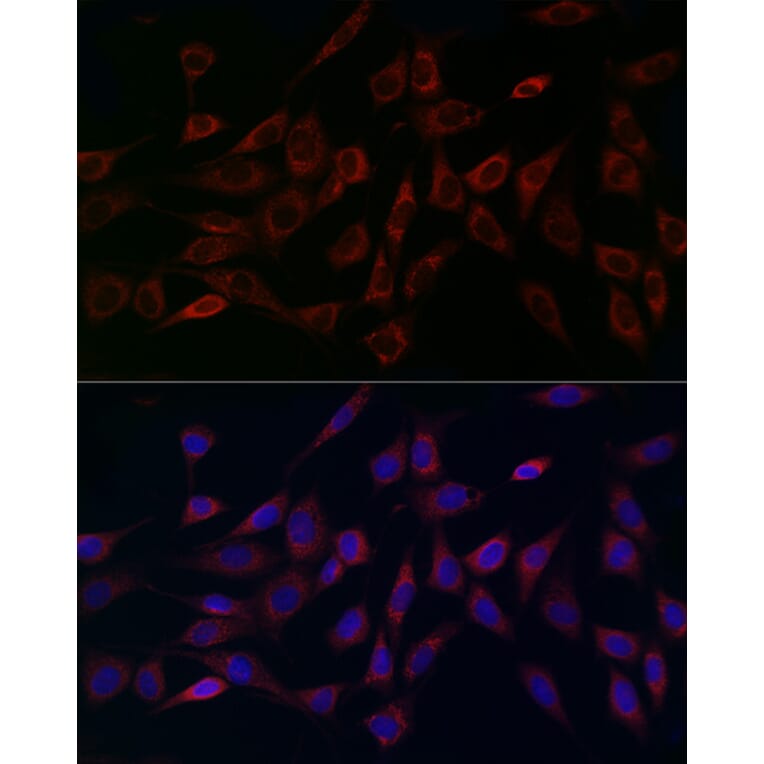 Immunofluorescence - Anti-MCU Antibody (A89422) - Antibodies.com