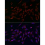 Immunofluorescence - Anti-MCU Antibody (A89422) - Antibodies.com