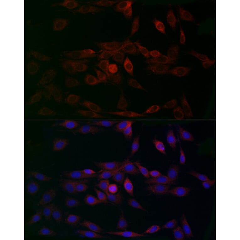 Immunofluorescence - Anti-MCU Antibody (A89422) - Antibodies.com