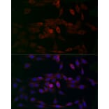 Immunofluorescence - Anti-MCU Antibody (A89422) - Antibodies.com