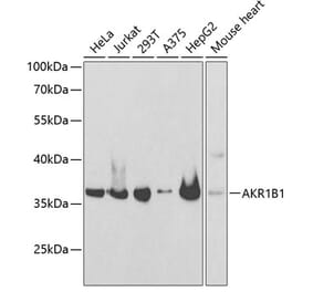 Western Blot - Anti-Aldose reductase Antibody (A89423) - Antibodies.com