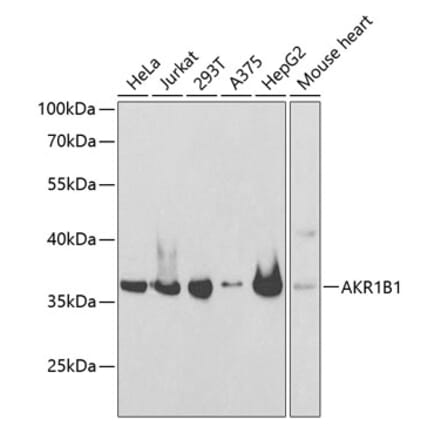 Western Blot - Anti-Aldose reductase Antibody (A89423) - Antibodies.com