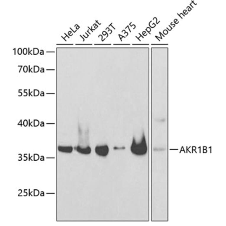 Western Blot - Anti-Aldose reductase Antibody (A89423) - Antibodies.com