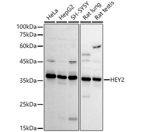 Western Blot - Anti-HEY2 Antibody (A89424) - Antibodies.com