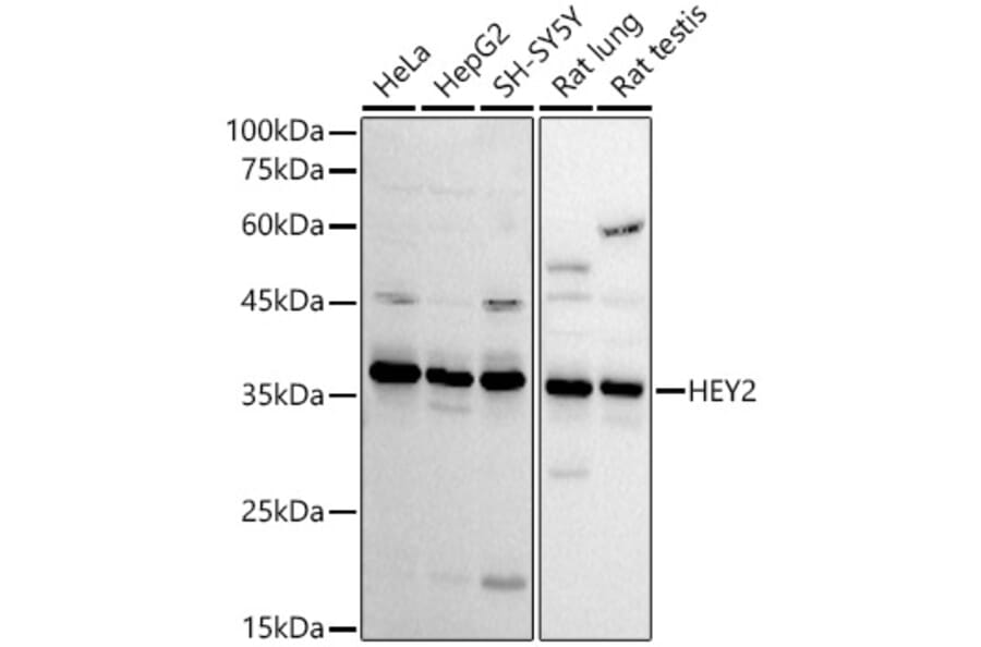 Western Blot - Anti-HEY2 Antibody (A89424) - Antibodies.com