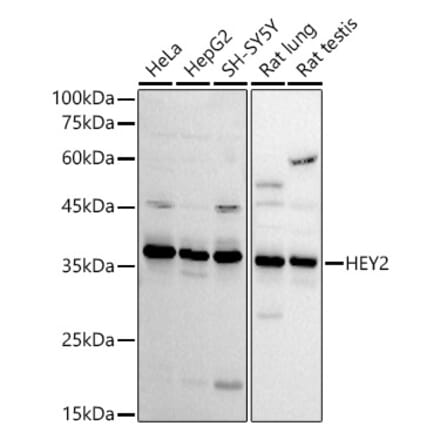 Western Blot - Anti-HEY2 Antibody (A89424) - Antibodies.com