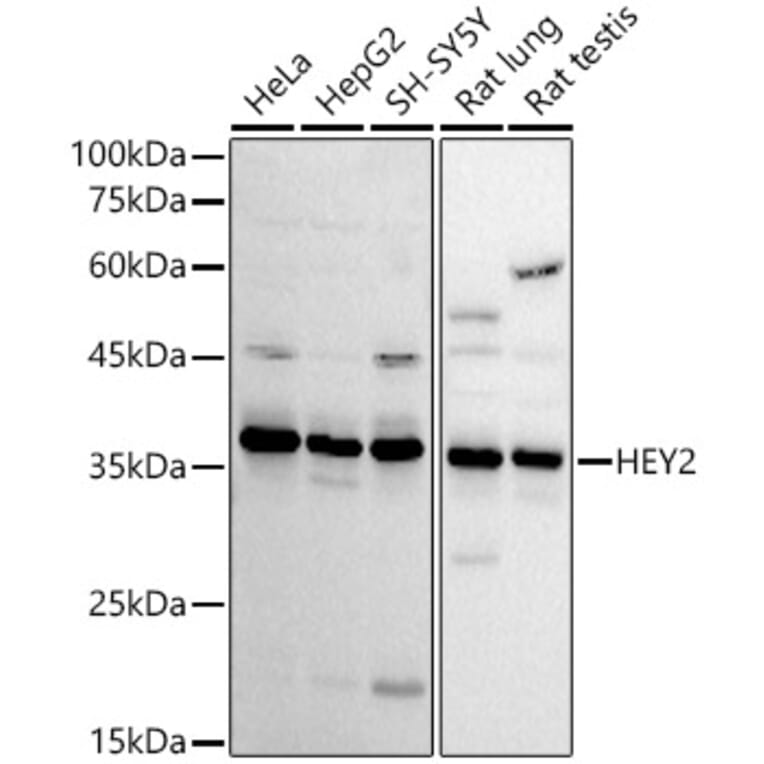 Western Blot - Anti-HEY2 Antibody (A89424) - Antibodies.com