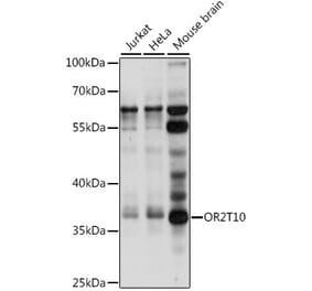 Western Blot - Anti-OR2T10 Antibody (A89425) - Antibodies.com