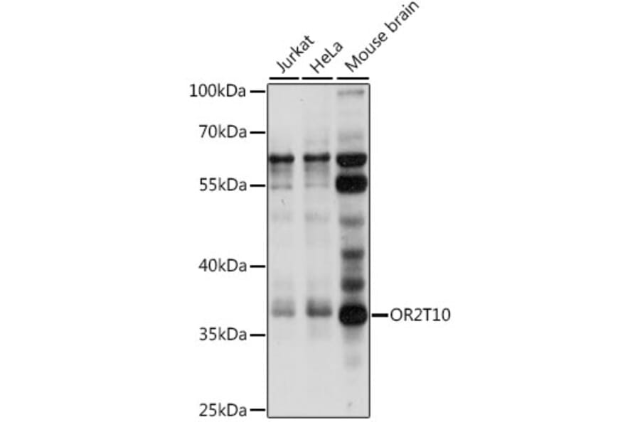 Western Blot - Anti-OR2T10 Antibody (A89425) - Antibodies.com