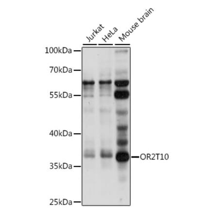 Western Blot - Anti-OR2T10 Antibody (A89425) - Antibodies.com