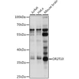 Western Blot - Anti-OR2T10 Antibody (A89425) - Antibodies.com