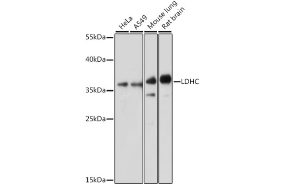 Western Blot - Anti-LDH-C Antibody (A89426) - Antibodies.com