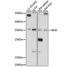 Western Blot - Anti-RhD Antibody (A89427) - Antibodies.com