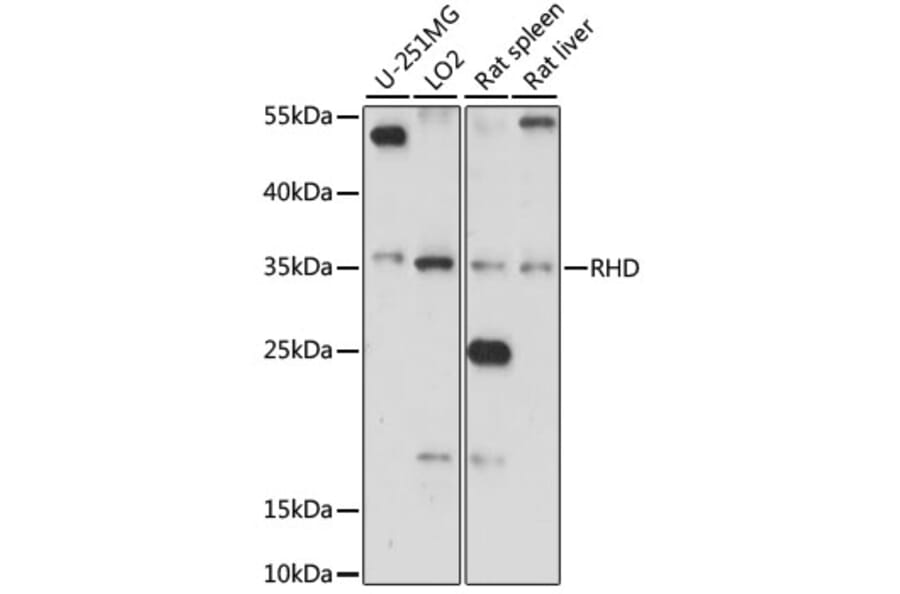 Western Blot - Anti-RhD Antibody (A89427) - Antibodies.com