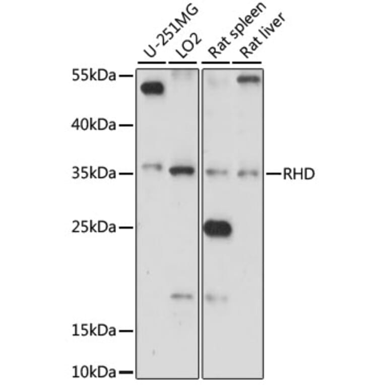 Western Blot - Anti-RhD Antibody (A89427) - Antibodies.com