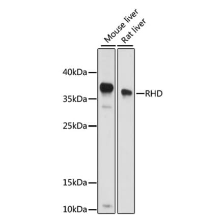 Western Blot - Anti-RhD Antibody (A89428) - Antibodies.com