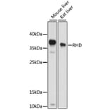 Western Blot - Anti-RhD Antibody (A89428) - Antibodies.com