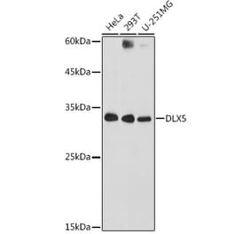 Western Blot - Anti-Dlx5 Antibody (A89430) - Antibodies.com