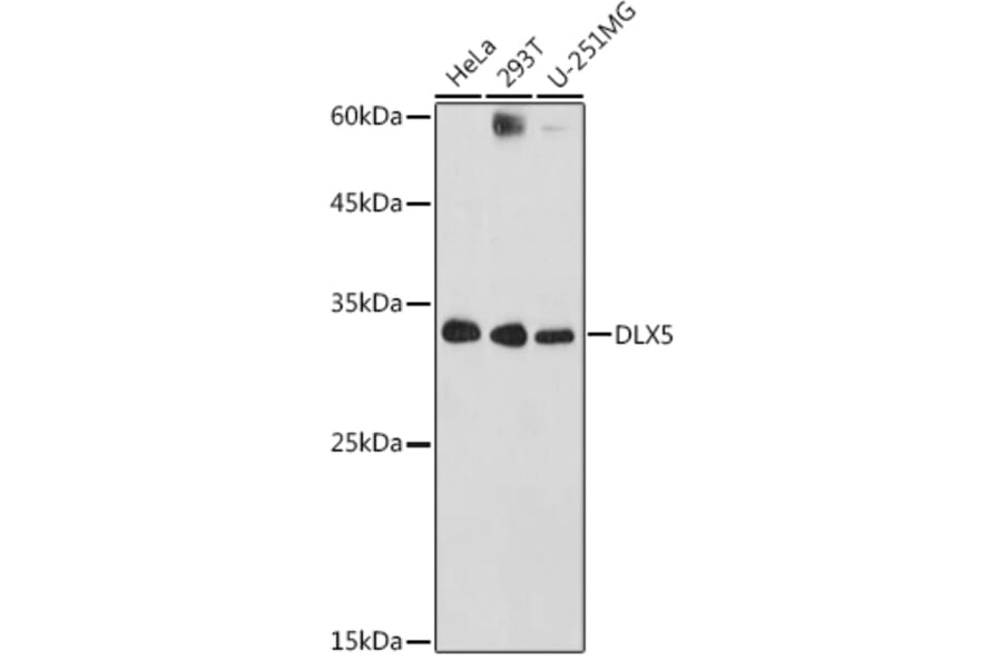 Western Blot - Anti-Dlx5 Antibody (A89430) - Antibodies.com