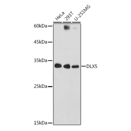 Western Blot - Anti-Dlx5 Antibody (A89430) - Antibodies.com