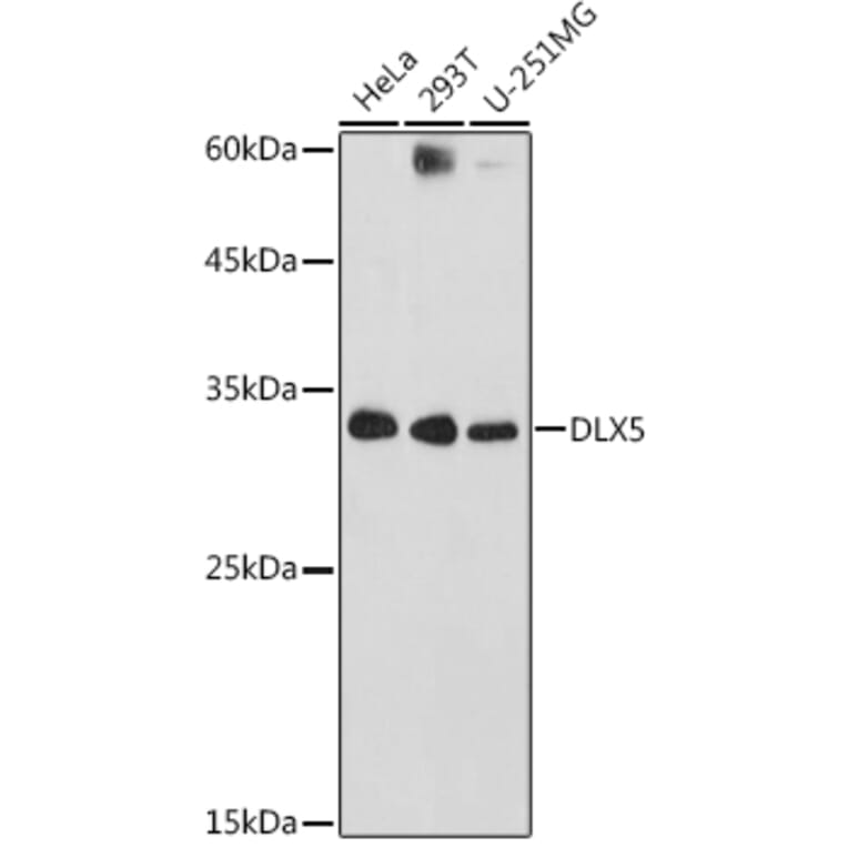 Western Blot - Anti-Dlx5 Antibody (A89430) - Antibodies.com