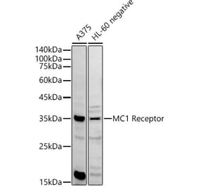 Western Blot - Anti-MC1-R Antibody (A89431) - Antibodies.com