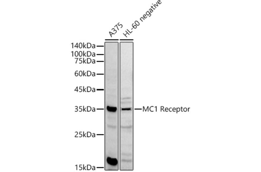 Western Blot - Anti-MC1-R Antibody (A89431) - Antibodies.com