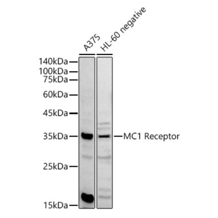 Western Blot - Anti-MC1-R Antibody (A89431) - Antibodies.com