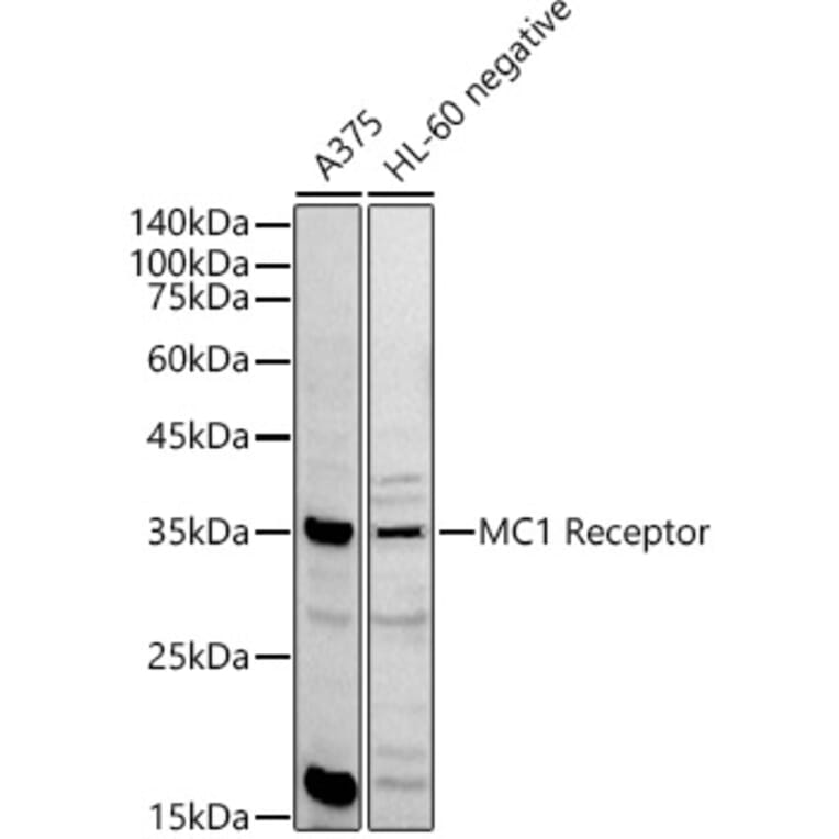 Western Blot - Anti-MC1-R Antibody (A89431) - Antibodies.com