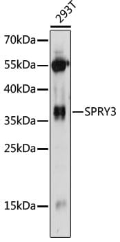Western blot analysis of extracts of 293T cells, using Anti-SPRY3 Antibody (A14669) at 1:1,000 dilution.
Secondary antibody: Goat Anti-Rabbit IgG (H+L) (HRP) (AS014) at 1:10,000 dilution.
Lysates / proteins: 25µg per lane.
Blocking buffer: 3% non-fat dry milk in TBST.
Detection: ECL Basic Kit (RM00020).
Exposure time: 60s.