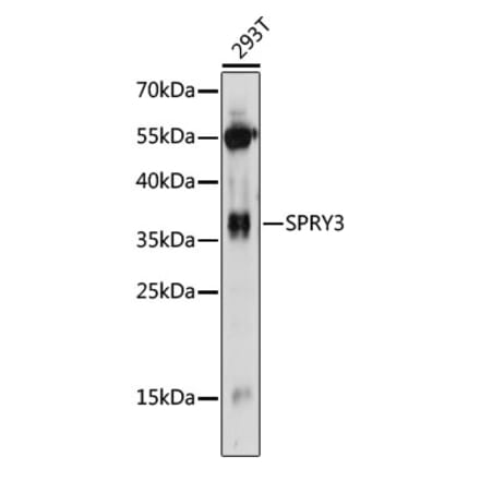 Western Blot - Anti-SPRY3 Antibody (A89432) - Antibodies.com