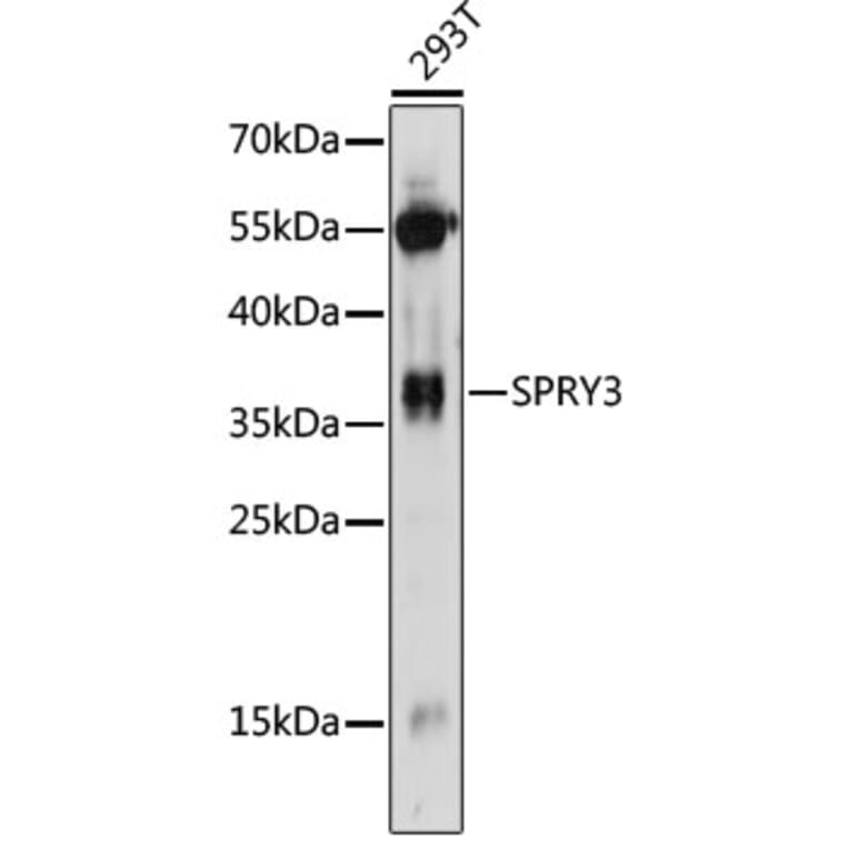 Western Blot - Anti-SPRY3 Antibody (A89432) - Antibodies.com