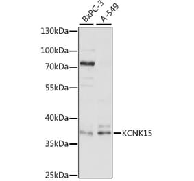 Western Blot - Anti-KCNK15 Antibody (A89433) - Antibodies.com