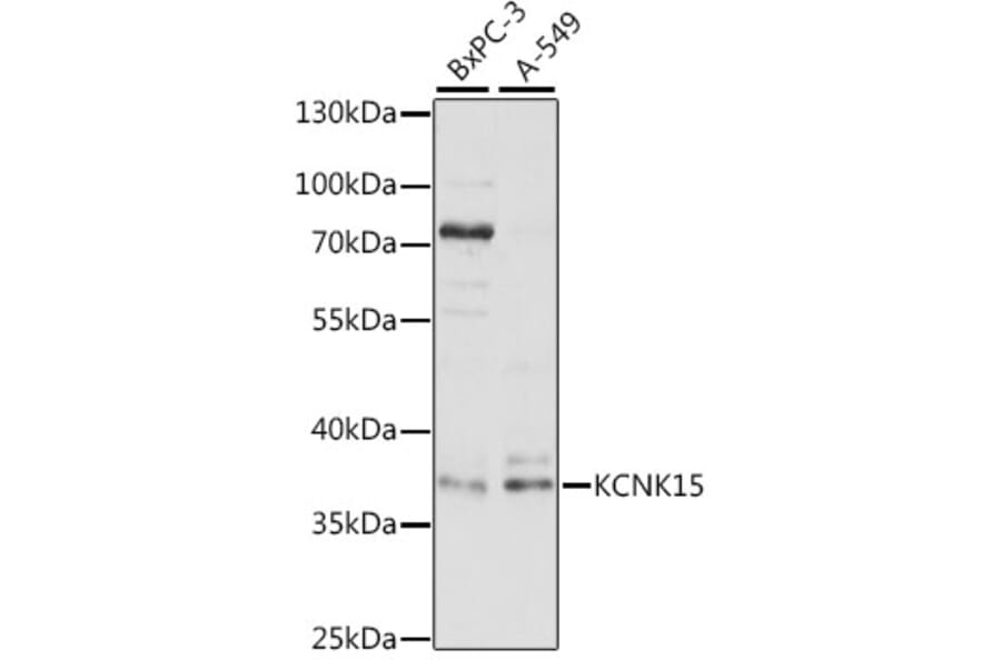 Western Blot - Anti-KCNK15 Antibody (A89433) - Antibodies.com